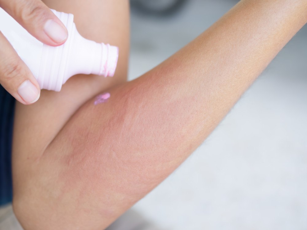 La calamine, fléau des bâtiments : causes, conséquences et solutions