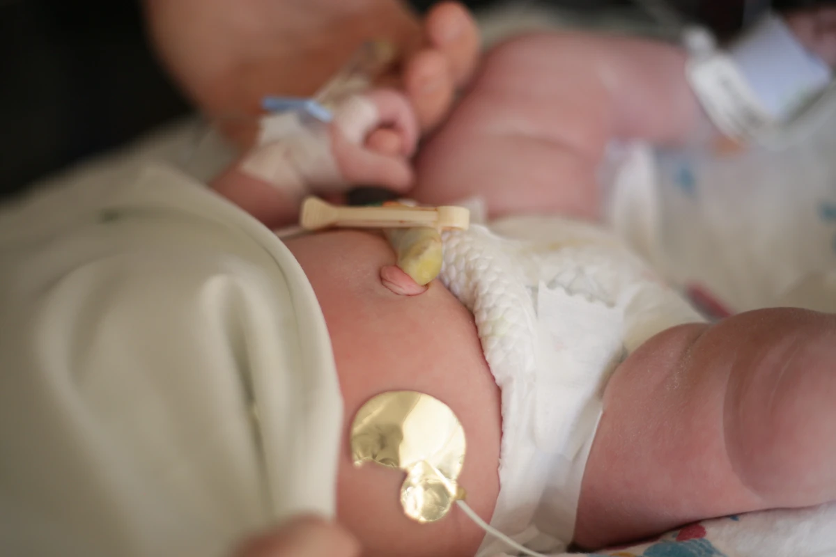 Babyphone connecté : sécurité renforcée pour surveiller bébé à distance